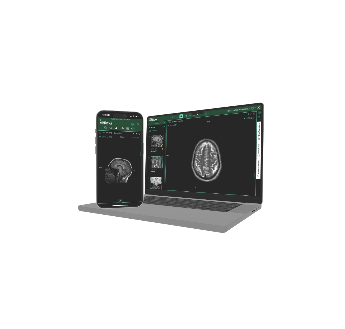 MedSynapse Viewer